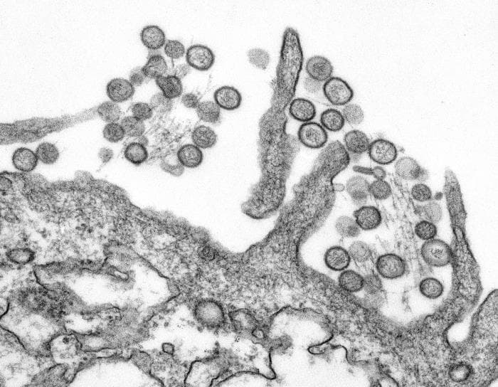 Transmission electron micrograph of Sin Nombre virus, a hantavirus associated with hantavirus pulmonary syndrome.